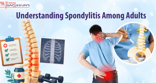 Understanding Spondylitis Among Adults
