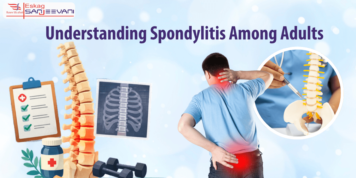 Understanding Spondylitis Among Adults