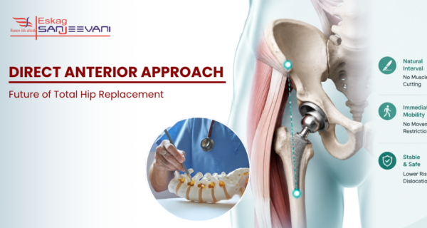 Direct anterior approach