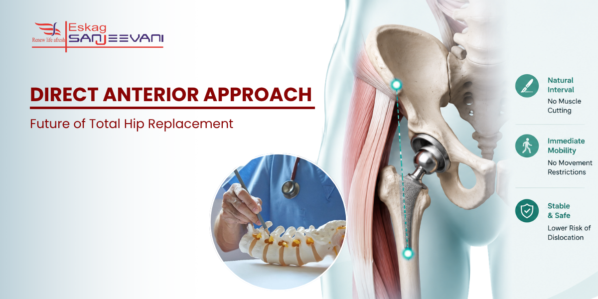 Direct anterior approach