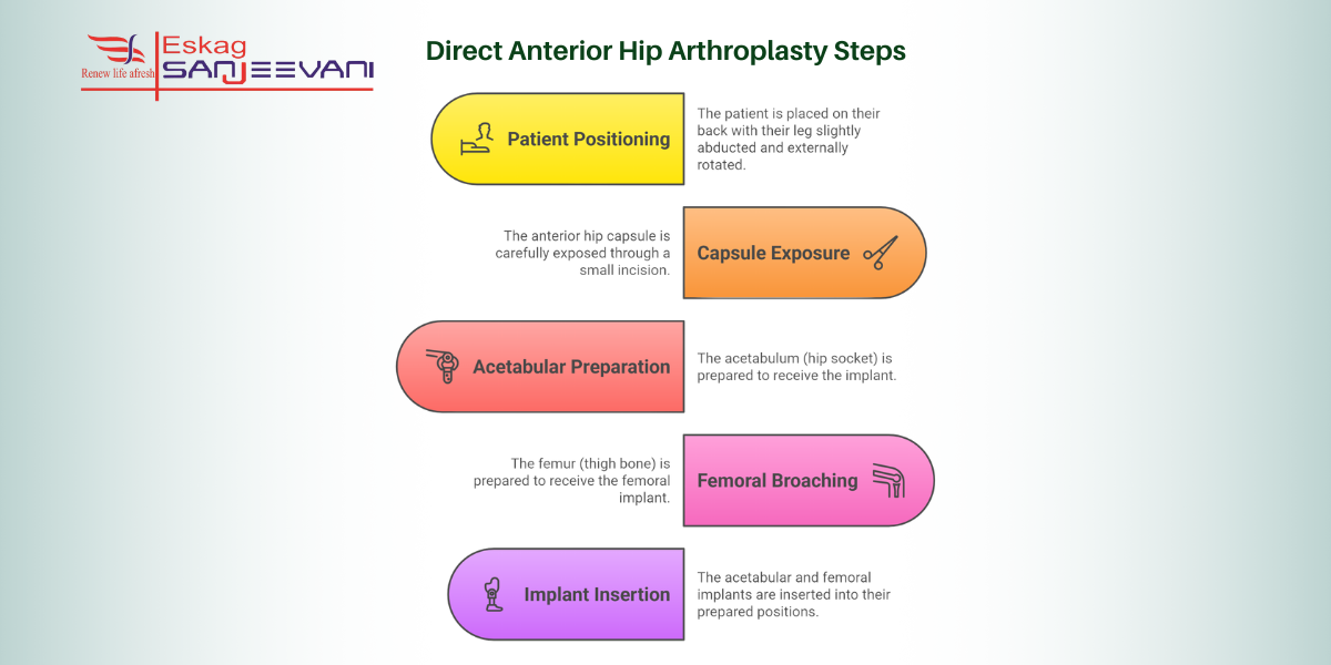 direct anterior hip arthroplasty steps