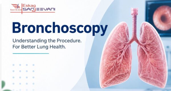 Bronchoscopy