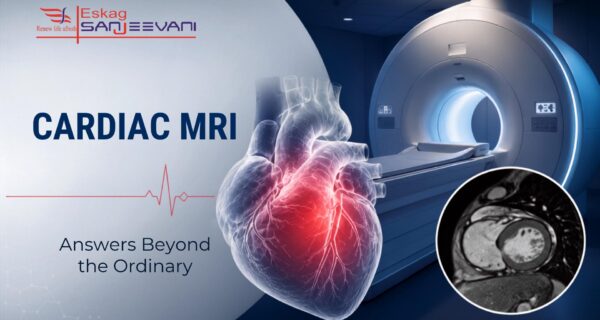 Cardiac MRI