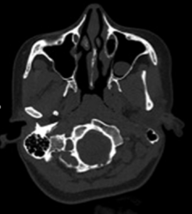 Case 1