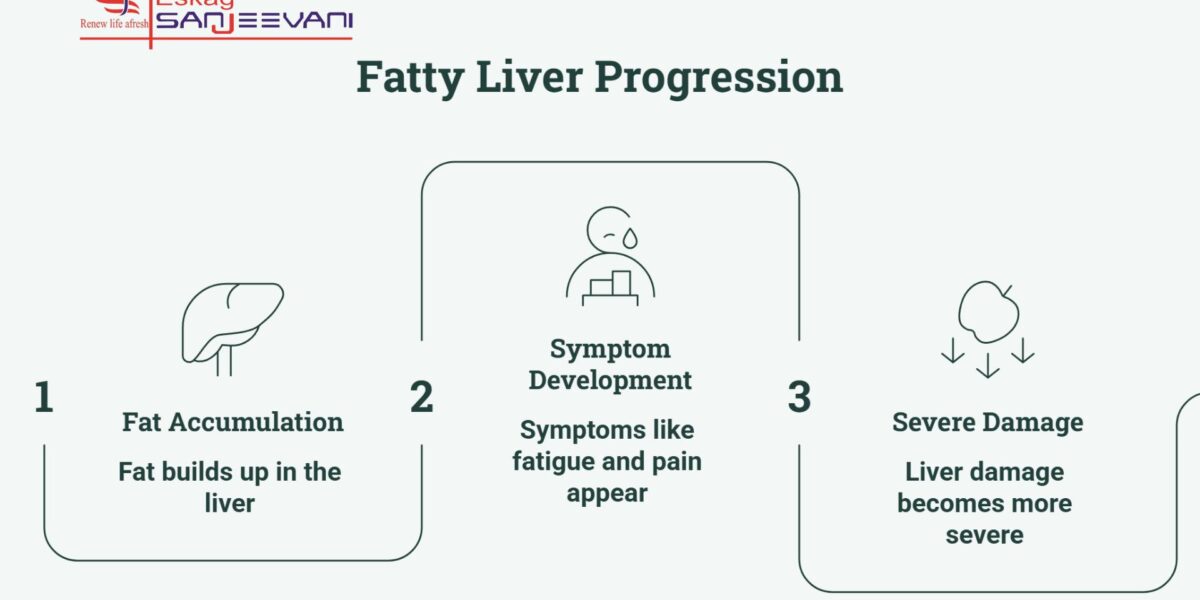 fatty liver progression