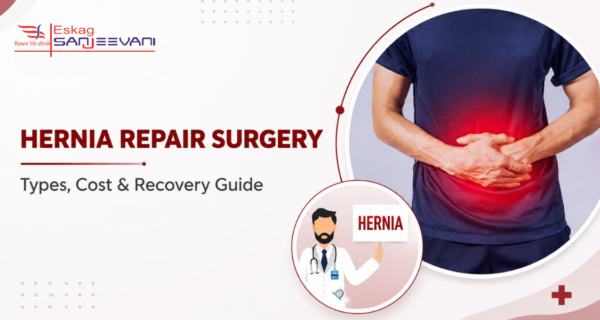 hernia repair surgery