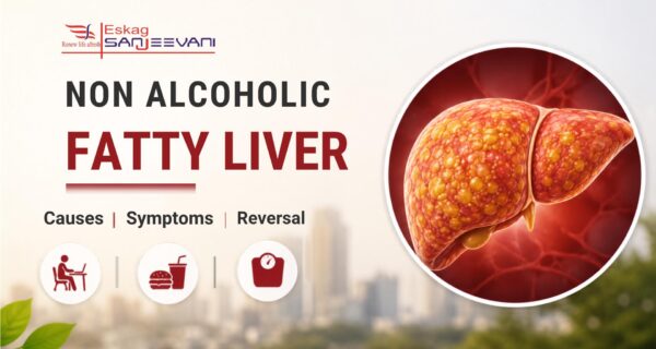 non alcoholic fatty liver