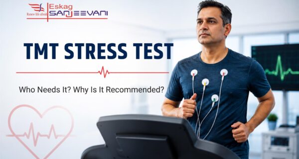 tmt stress test