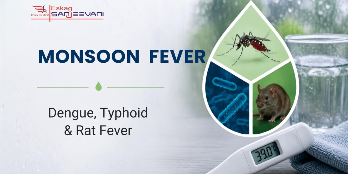 Monsoon Fever