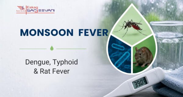 Monsoon Fever
