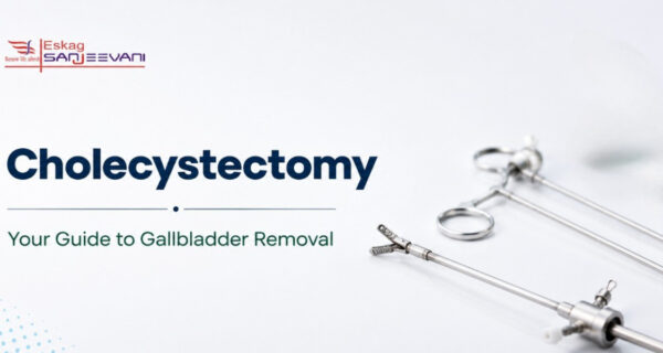 cholecystectomy
