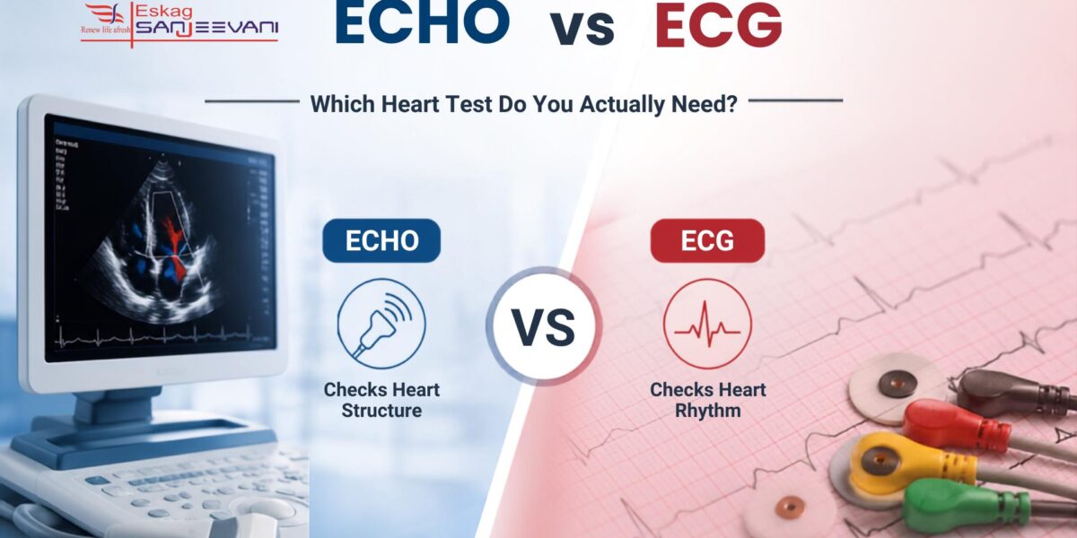 echo vs ecg