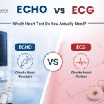 echo vs ecg