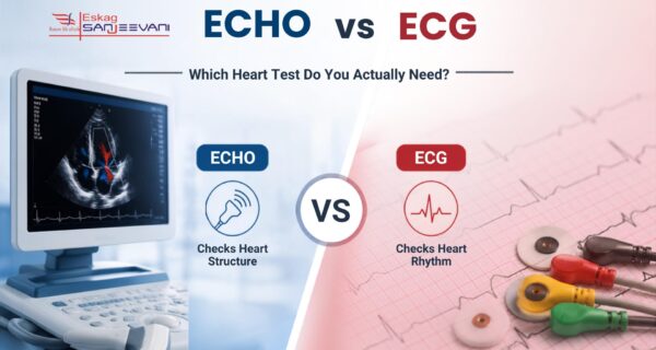 echo vs ecg