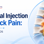 epidurial injection for back pain
