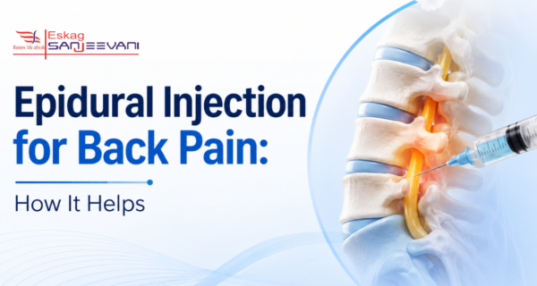 epidurial injection for back pain