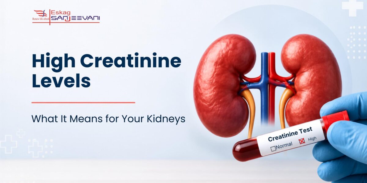 high creatinine levels