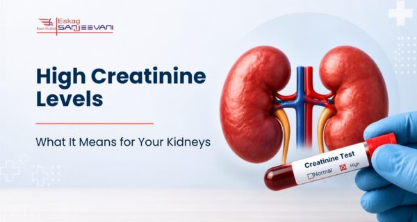 high creatinine levels