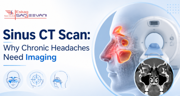 sinus CT scan