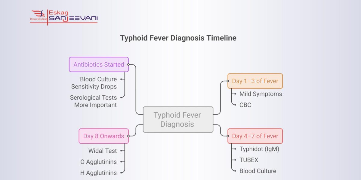 typhoid fever diagnosis