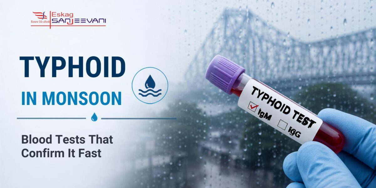 typhoid in monsoon