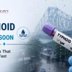 typhoid in monsoon