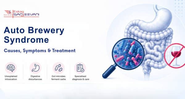 symptoms of auto brewery syndrome