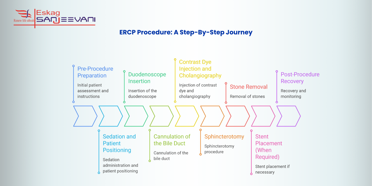 ERCP Procedure A Step-By-Step Journey