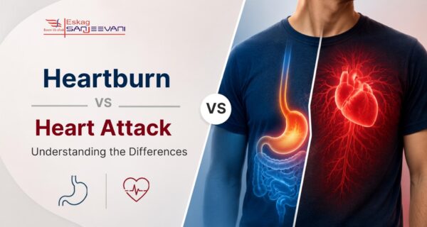 Heartburn vs Heart Attack