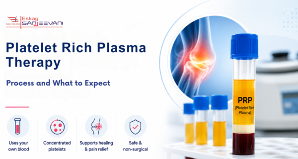 Platelet Rich Plasma Therapy