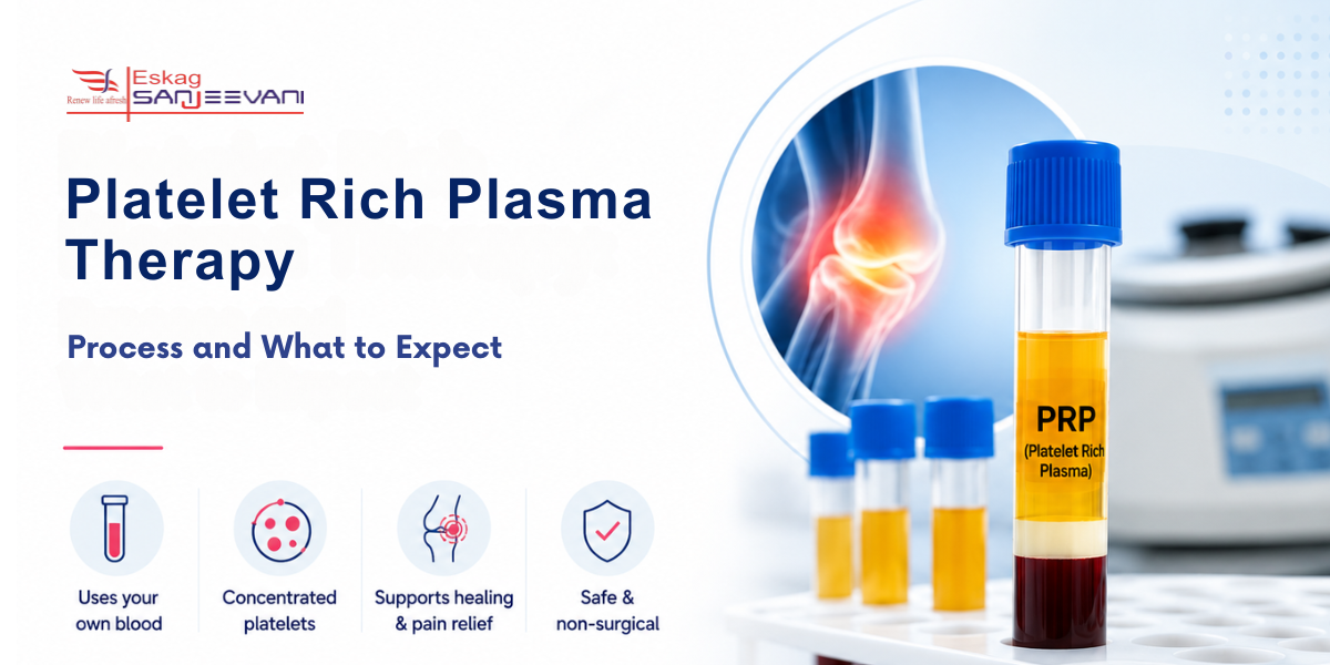 Platelet Rich Plasma Therapy
