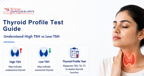Thyroid Profile Test