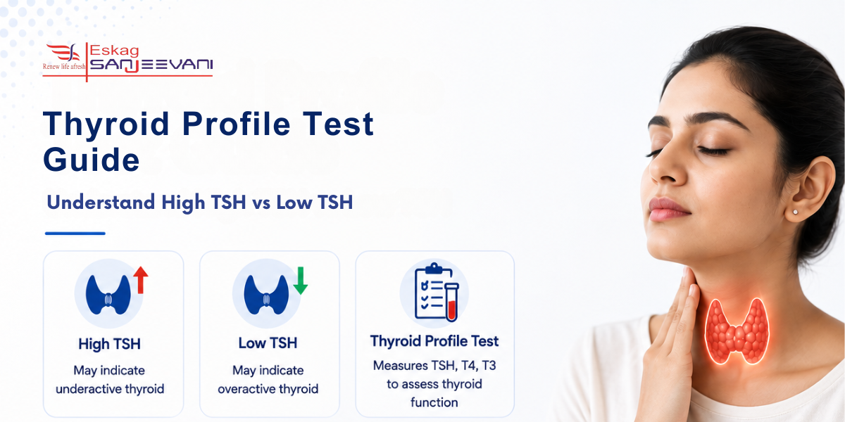 Thyroid Profile Test