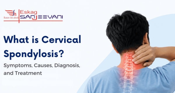 what is cervical spondylosis