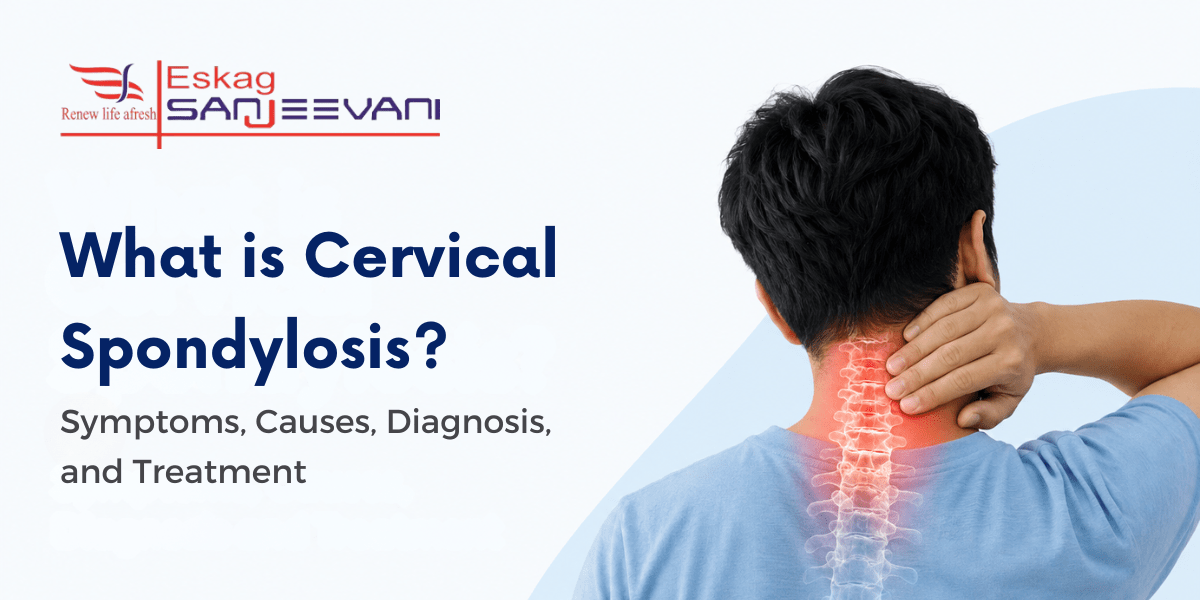 what is cervical spondylosis
