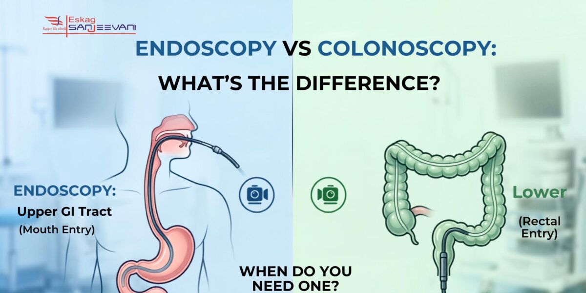 endocopy vs colonoscopy