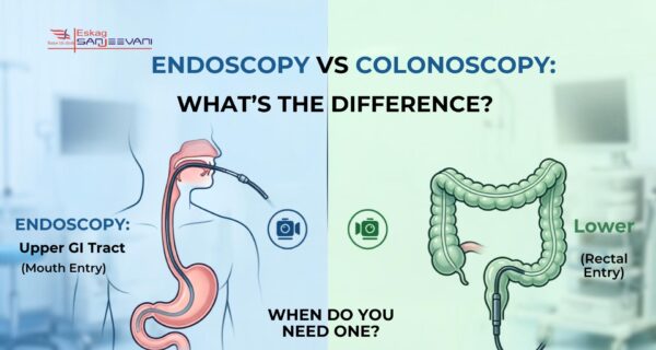 endocopy vs colonoscopy