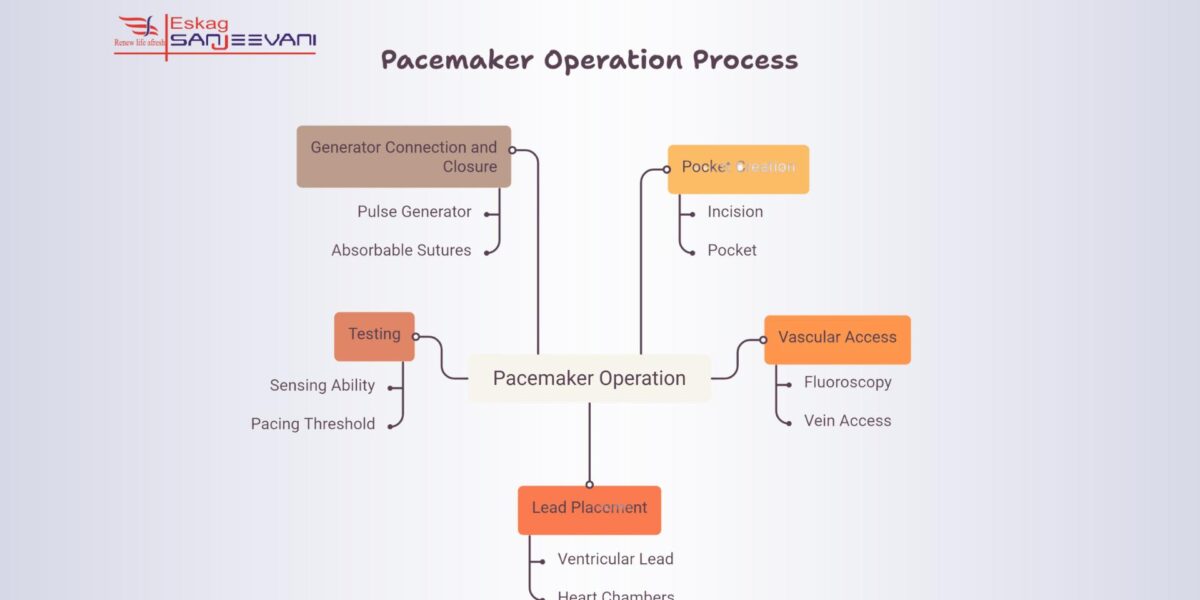pacemaker operation process