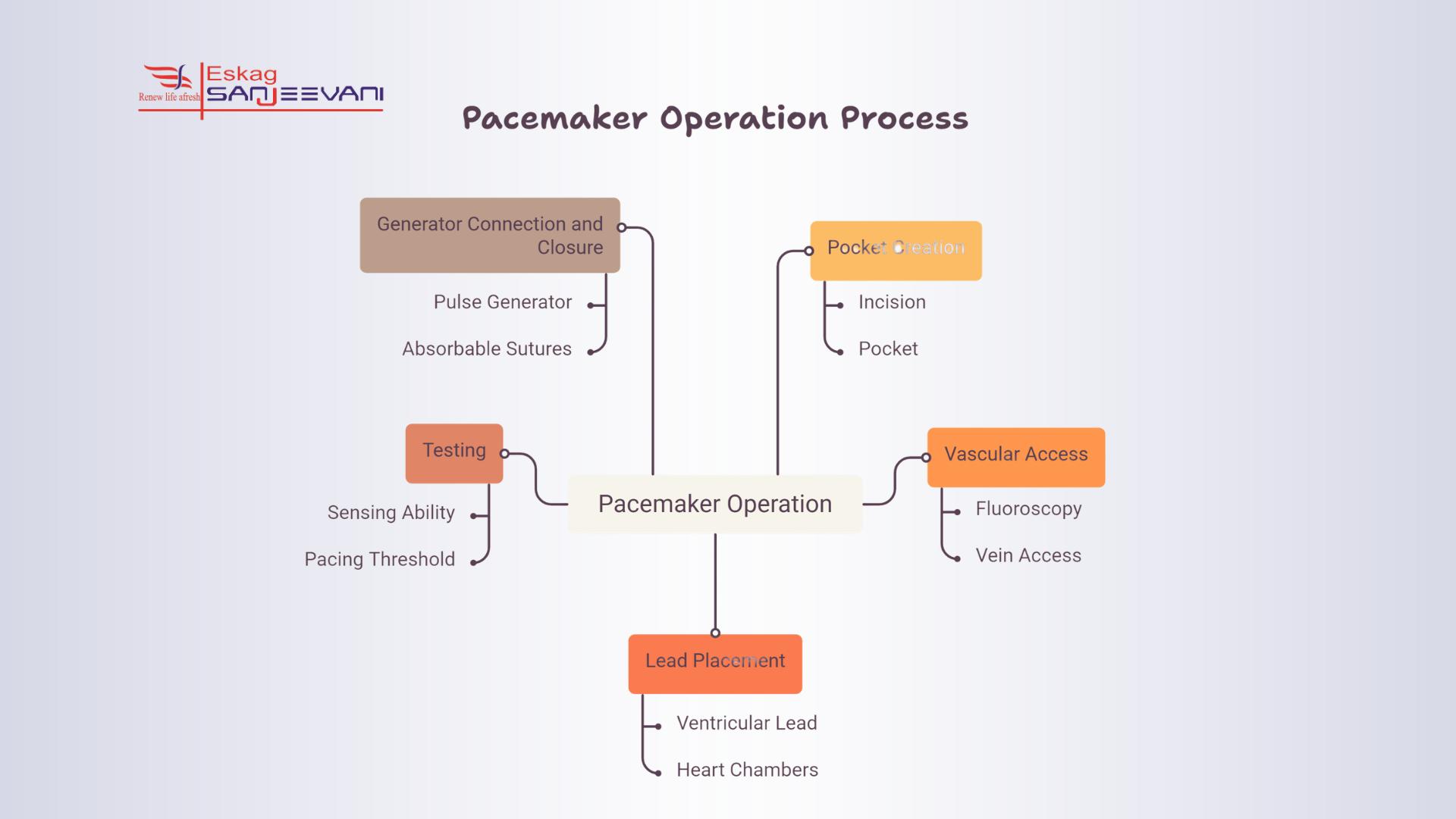 pacemaker operation process