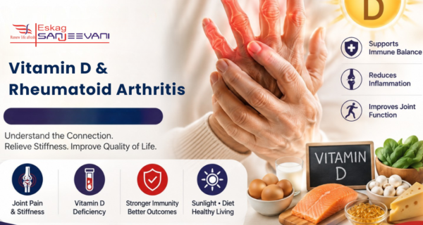 vitamin D and rheumatoid arthritis
