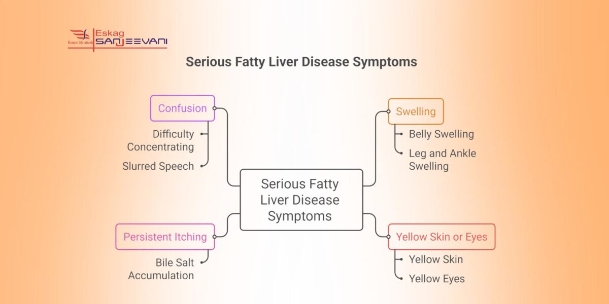 serious fatty liver symptoms